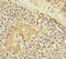 Alpha-1,4-N-Acetylglucosaminyltransferase antibody, A62026-100, Epigentek, Immunohistochemistry paraffin image 