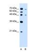 Zinc Finger FYVE-Type Containing 27 antibody, NBP1-59421, Novus Biologicals, Western Blot image 