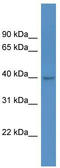 4-Hydroxyphenylpyruvate Dioxygenase Like antibody, TA343015, Origene, Western Blot image 
