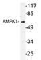 Protein Kinase AMP-Activated Catalytic Subunit Alpha 1 antibody, AP20963PU-N, Origene, Western Blot image 