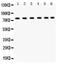 Transient Receptor Potential Cation Channel Subfamily V Member 5 antibody, PB9518, Boster Biological Technology, Western Blot image 