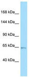 Unc-5 Netrin Receptor C antibody, TA338214, Origene, Western Blot image 