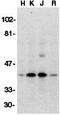 DNA Fragmentation Factor Subunit Beta antibody, GTX31261, GeneTex, Western Blot image 