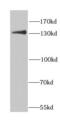 Centromere Protein C antibody, FNab01584, FineTest, Western Blot image 