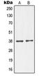 NK2 Homeobox 1 antibody, LS-C352944, Lifespan Biosciences, Western Blot image 