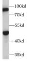 Terminal Nucleotidyltransferase 4B antibody, FNab06139, FineTest, Western Blot image 