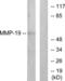 Matrix Metallopeptidase 19 antibody, LS-C118524, Lifespan Biosciences, Western Blot image 