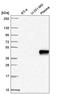 Zinc Finger Protein 672 antibody, HPA062506, Atlas Antibodies, Western Blot image 