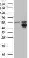 Glycerol-3-Phosphate Acyltransferase 3 antibody, CF809768, Origene, Western Blot image 