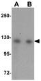 Ubiquitin Specific Peptidase 10 antibody, GTX31416, GeneTex, Western Blot image 