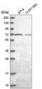 Golgi Associated, Gamma Adaptin Ear Containing, ARF Binding Protein 2 antibody, NBP2-58645, Novus Biologicals, Western Blot image 