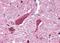 Cannabinoid receptor 1 antibody, NLS32, Novus Biologicals, Immunohistochemistry paraffin image 