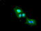 DNA Fragmentation Factor Subunit Alpha antibody, GTX84621, GeneTex, Immunofluorescence image 