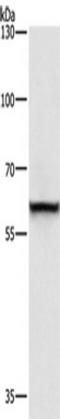 Thyroid Hormone Receptor Interactor 4 antibody, TA349662, Origene, Western Blot image 