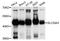 Equilibrative nucleoside transporter 3 antibody, A10377, ABclonal Technology, Western Blot image 