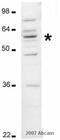 Protein disulfide-isomerase A2 antibody, ab3672, Abcam, Western Blot image 