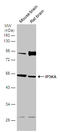 Inositol-Trisphosphate 3-Kinase A antibody, GTX133334, GeneTex, Western Blot image 