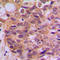 SMAD Family Member 3 antibody, LS-C354028, Lifespan Biosciences, Immunohistochemistry paraffin image 