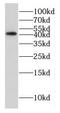 E2F Associated Phosphoprotein antibody, FNab02610, FineTest, Western Blot image 