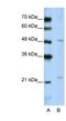 WD Repeat Domain 12 antibody, NBP1-53111, Novus Biologicals, Western Blot image 