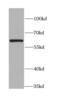 C-X-C Motif Chemokine Receptor 4 antibody, FNab02102, FineTest, Western Blot image 
