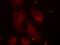 LIM domain kinase 1 antibody, LS-C336025, Lifespan Biosciences, Immunofluorescence image 