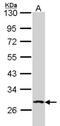 Dual Specificity Phosphatase 2 antibody, NBP2-14934, Novus Biologicals, Western Blot image 