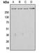 APC Regulator Of WNT Signaling Pathway antibody, MBS821849, MyBioSource, Western Blot image 