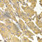 Protein Phosphatase 2 Catalytic Subunit Alpha antibody, A6702, ABclonal Technology, Immunohistochemistry paraffin image 