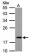 Acireductone Dioxygenase 1 antibody, GTX118578, GeneTex, Western Blot image 