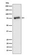 Beta-adrenergic receptor kinase 2 antibody, M20057, Boster Biological Technology, Western Blot image 
