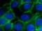Catenin Beta 1 antibody, 17565-1-AP, Proteintech Group, Immunofluorescence image 