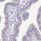 Dynein Axonemal Heavy Chain 14 antibody, PA5-56720, Invitrogen Antibodies, Immunohistochemistry paraffin image 