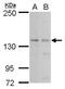 Poly(A) Specific Ribonuclease Subunit PAN2 antibody, PA5-78303, Invitrogen Antibodies, Western Blot image 