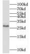 Telomerase RNA Component Interacting RNase antibody, FNab01050, FineTest, Western Blot image 