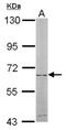 Cytosolic purine 5 -nucleotidase antibody, NBP1-31404, Novus Biologicals, Western Blot image 