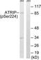 ATR Interacting Protein antibody, TA312611, Origene, Western Blot image 
