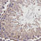 Butyrylcholinesterase antibody, LS-C331478, Lifespan Biosciences, Immunohistochemistry frozen image 