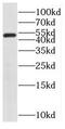 Sorting Nexin 15 antibody, FNab08083, FineTest, Western Blot image 