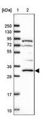 Protein Kinase AMP-Activated Non-Catalytic Subunit Beta 2 antibody, PA5-60678, Invitrogen Antibodies, Western Blot image 