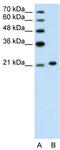 Ankyrin-1 antibody, TA344171, Origene, Western Blot image 