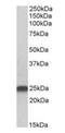 Lin-7 Homolog B, Crumbs Cell Polarity Complex Component antibody, orb18611, Biorbyt, Western Blot image 