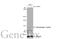 Protein Tyrosine Kinase 2 antibody, GTX635714, GeneTex, Western Blot image 