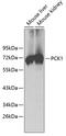 Phosphoenolpyruvate Carboxykinase 1 antibody, GTX54629, GeneTex, Western Blot image 