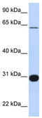 Ral GEF With PH Domain And SH3 Binding Motif 1 antibody, TA344101, Origene, Western Blot image 