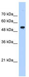 Interferon Induced Protein With Tetratricopeptide Repeats 3 antibody, TA338978, Origene, Western Blot image 