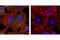 Catenin Beta 1 antibody, 2677S, Cell Signaling Technology, Immunofluorescence image 