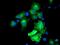 Monoglyceride Lipase antibody, MA5-25582, Invitrogen Antibodies, Immunocytochemistry image 
