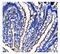 CD13 antibody, M02591-5, Boster Biological Technology, Immunohistochemistry paraffin image 