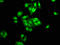 Pygopus homolog 2 antibody, LS-C673147, Lifespan Biosciences, Immunofluorescence image 
